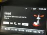 USED 2018 18 VAUXHALL MOKKA X 1.4 ACTIVE 5d 138 BHP BLUETOOTH DAB CRUISE CONTROL PARKING SENSORS