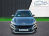 USED 2021 21 HYUNDAI KONA 1.6 GDI ULTIMATE 5d 140 BHP ** RAC BUYSURE INSPECTED **