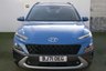 USED 2021 71 HYUNDAI KONA 1.6 GDI ULTIMATE 5d 140 BHP 