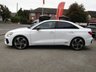 USED 2020 70 AUDI A3 1.5 TFSI 35 Edition 1 Saloon 4dr Petrol Manual Euro 6 (s/s) (150 ps) Finished in IBIS WHITE with contrasting LEATHER/ALCANTARA Heated Memory SPORTS trim. This Audi A3 Saloon is a classy, high tech four-door that is also great to drive. This A3 saloon is a sleeker-looking version of the Audi A3 Sportback hatchback. Features include Nav, Virtual Dash, DAB, Heated Memory Sports Trim, Tinted windows, B/tooth, 19" Alloys, Black Pack, Apple Car Play, Power Folding Door Mirrors and more. AUDI Dealer serviced at 17356 miles, 33613 miles, 47960 miles and at 63624 miles