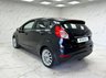 USED 2016 16 FORD FIESTA 1.0T EcoBoost Titanium X Hatchback 5dr Petrol Manual Euro 6 (s/s) (125 ps) F/S/H X10!!! 1 OWNER FROM NEW!  F/S/H X10!!! 1 OWNER FROM NEW!