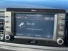 USED 2017 17 KIA RIO 1.4 CRDi 3 Hatchback 5dr Diesel Manual Euro 6 (s/s) (89 bhp) 115878 miles