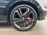 USED 2026 26 SKODA FABIA 1.5L 130 5d  AUTO  174 BHP 130 SPECIAL EDITION - 174 BHP